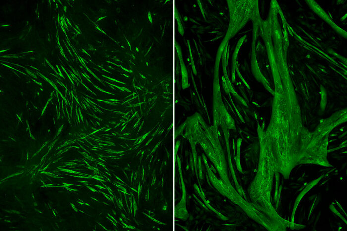 На изображении слева мышечные волокна нормального размера. На изображении справа мышечные волокна выросли в три раза больше из-за удалённого гена DNAJB6